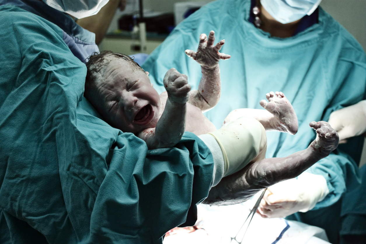 De ce se nasc bebelușii cu o vedere slabă Vedere slabă de la naștere