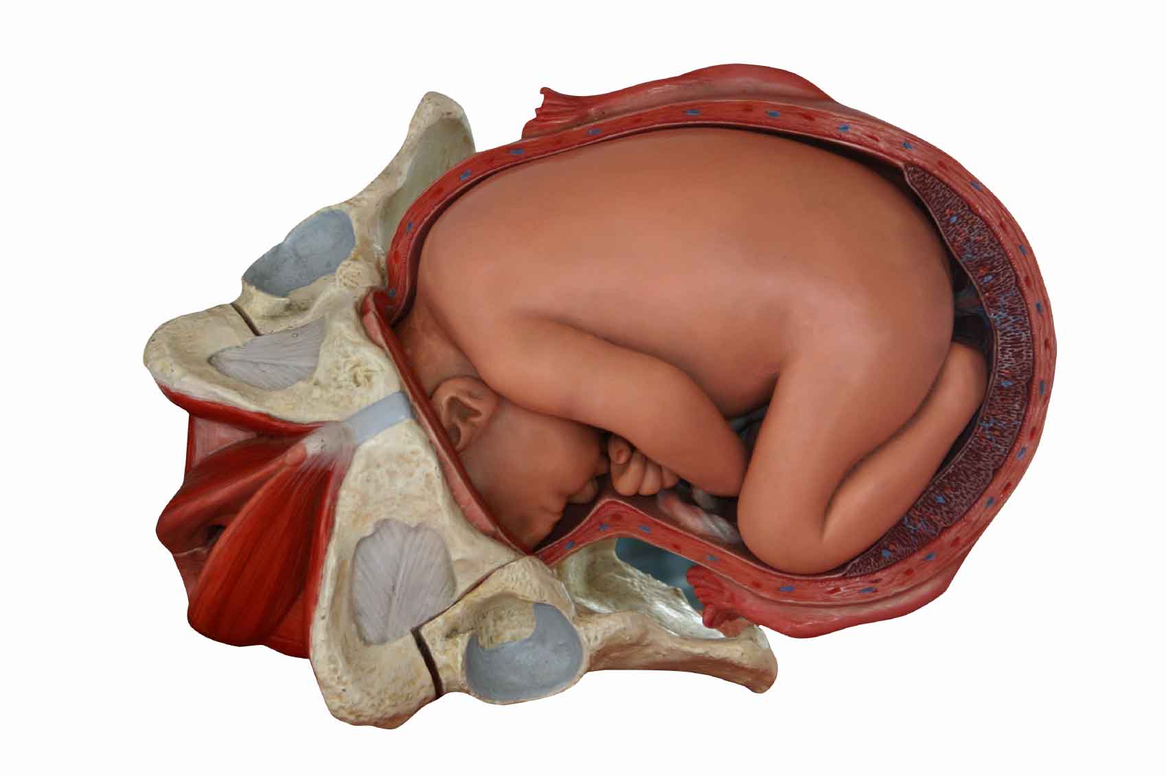 Беременность большая голова. Крупный плод при беременности. Рождение ребенка по родовым путям.