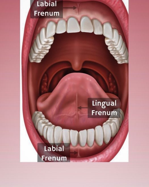 ilustratie cu frenul lingual