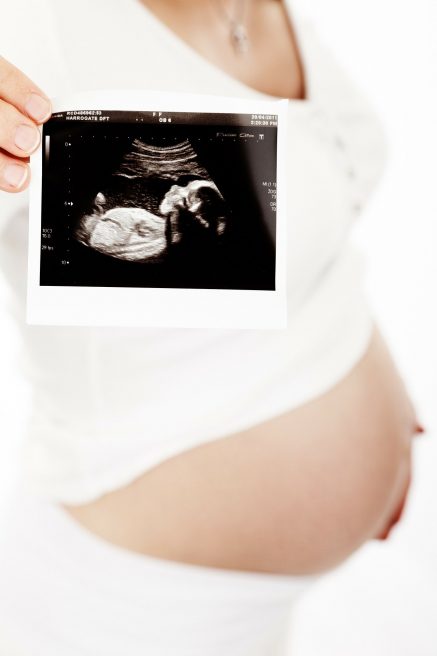 Femeie însărcinată care ține în mână o ecografie 